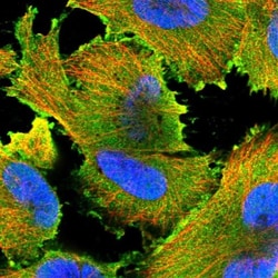 Aiolos/IKZF3 Antibody, Novus Biologicals:Antibodies:Primary Antibodies